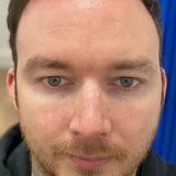 "J'ai acheté les grands formats et j'ai continué le traitement. 1 an ma peau est apaisée." Alex