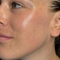 PEAU APAISÉE