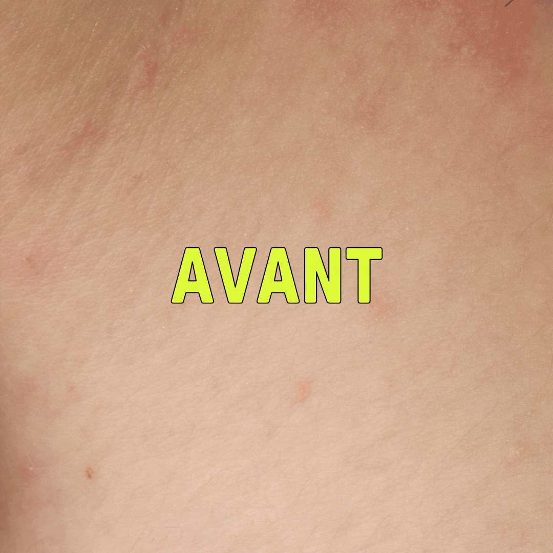 NOTRE TRIO PEAU GRASSE