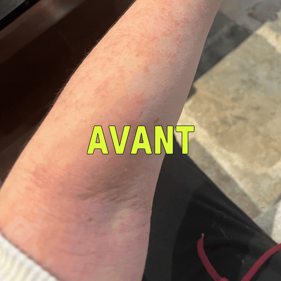 NOTRE KIT IRRITATIONS