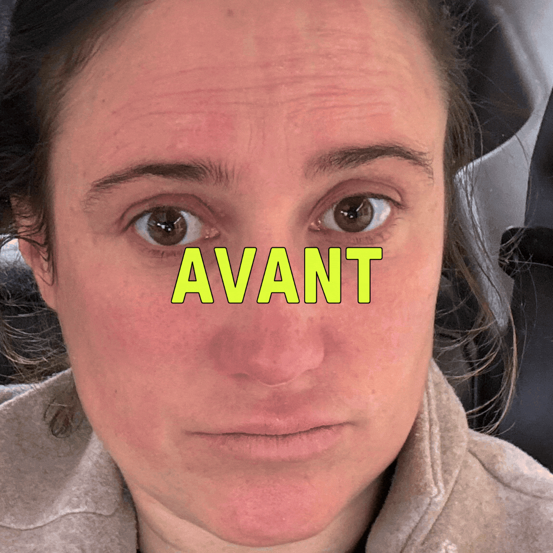 NOTRE KIT IRRITATIONS