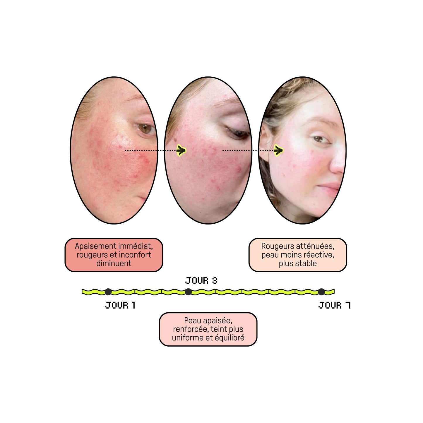 SOS INFLAMMATIONS
