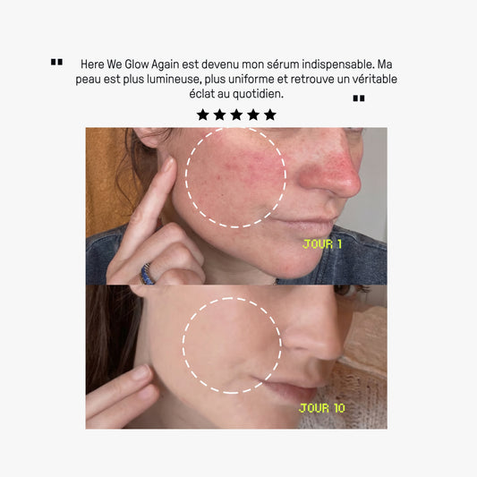 RESET STRESS + PEAU